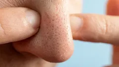 Tento problém trápí mnoho lidí, ale ne všichni vědí, jak snadno se dá vyřešit.